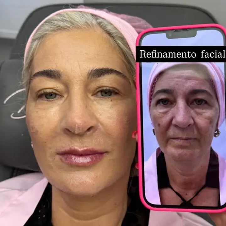 AnyConv.com__01-facial