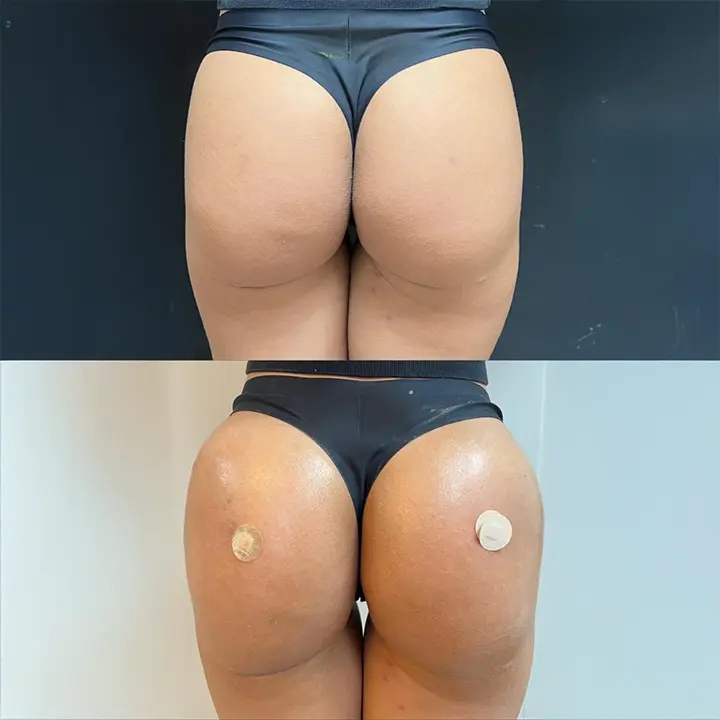 AnyConv.com__01-novo-gluteo-editado