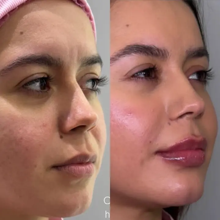 AnyConv.com__02-facial