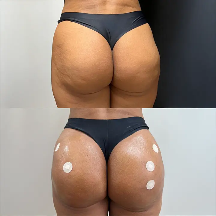 AnyConv.com__02-novo-gluteo-editado