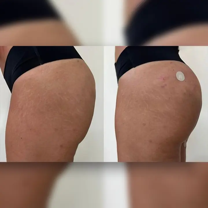 AnyConv.com__04-gluteo