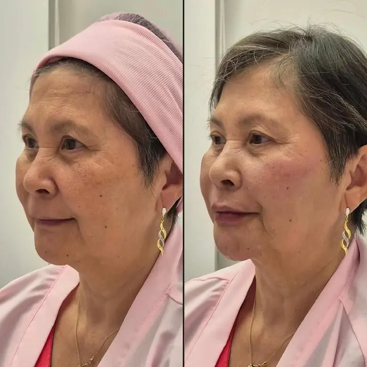 AnyConv.com__06-facial