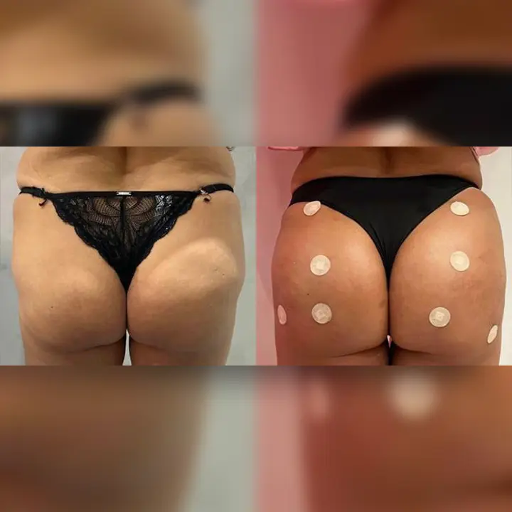 AnyConv.com__08-gluteo